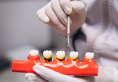 Porseleinen Kroon Tandarts In Antalya, Turkije Maak Nu Een Afspraak