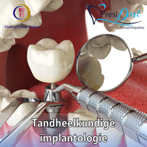 implant dentaire alanya