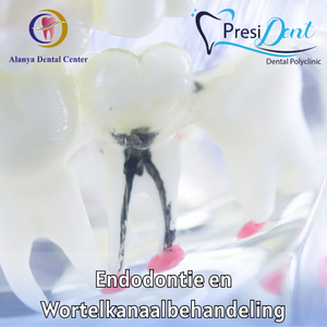 implantaat tand prijs