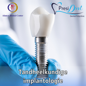 implantaten klikgebit